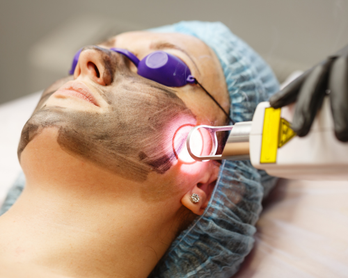 Laser and Skin